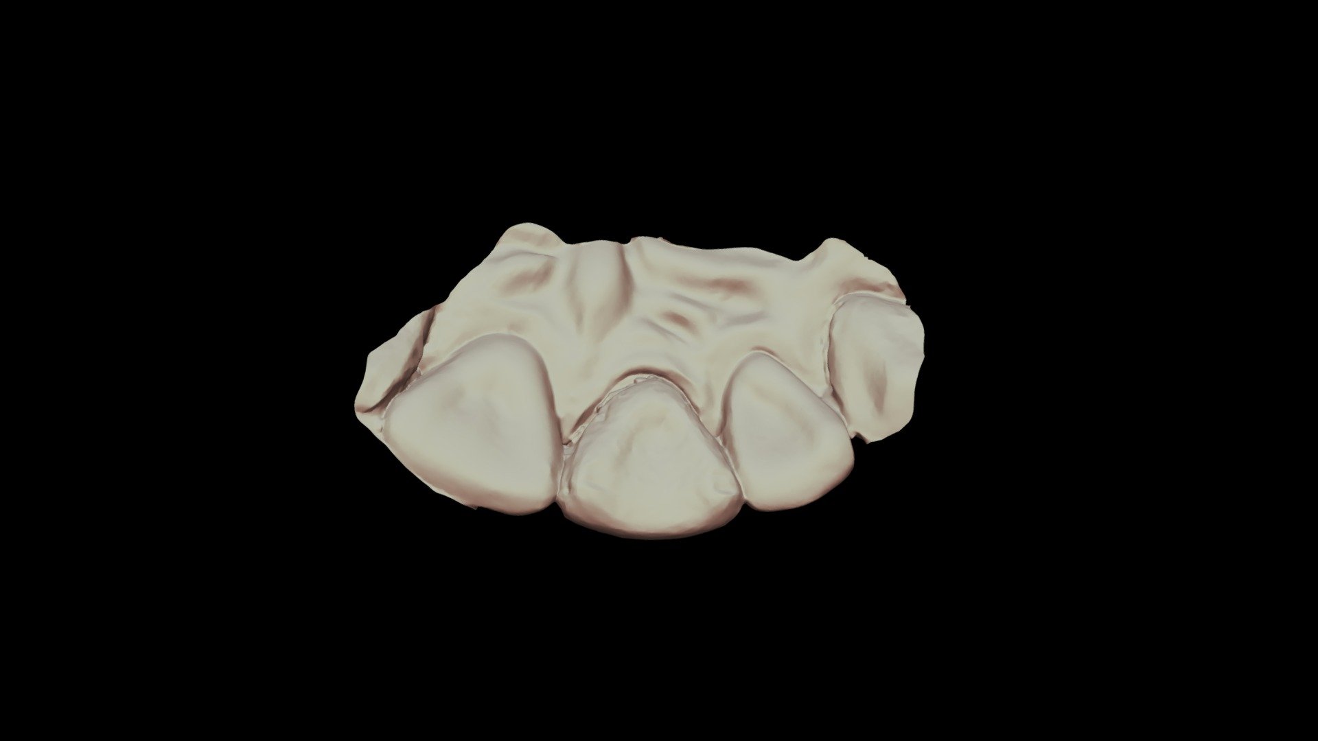 #8 Wax2, Group 8, Scanner 2 Upper Jaw