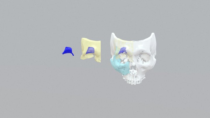 20260203-02 3D Model