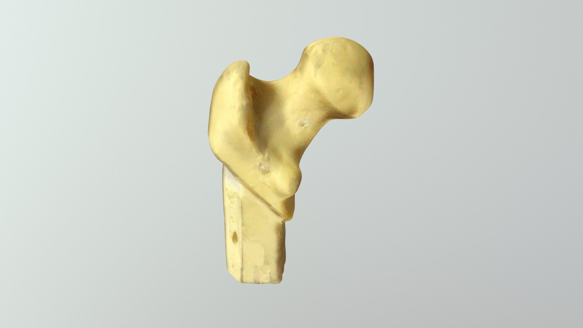 Hip Bone
