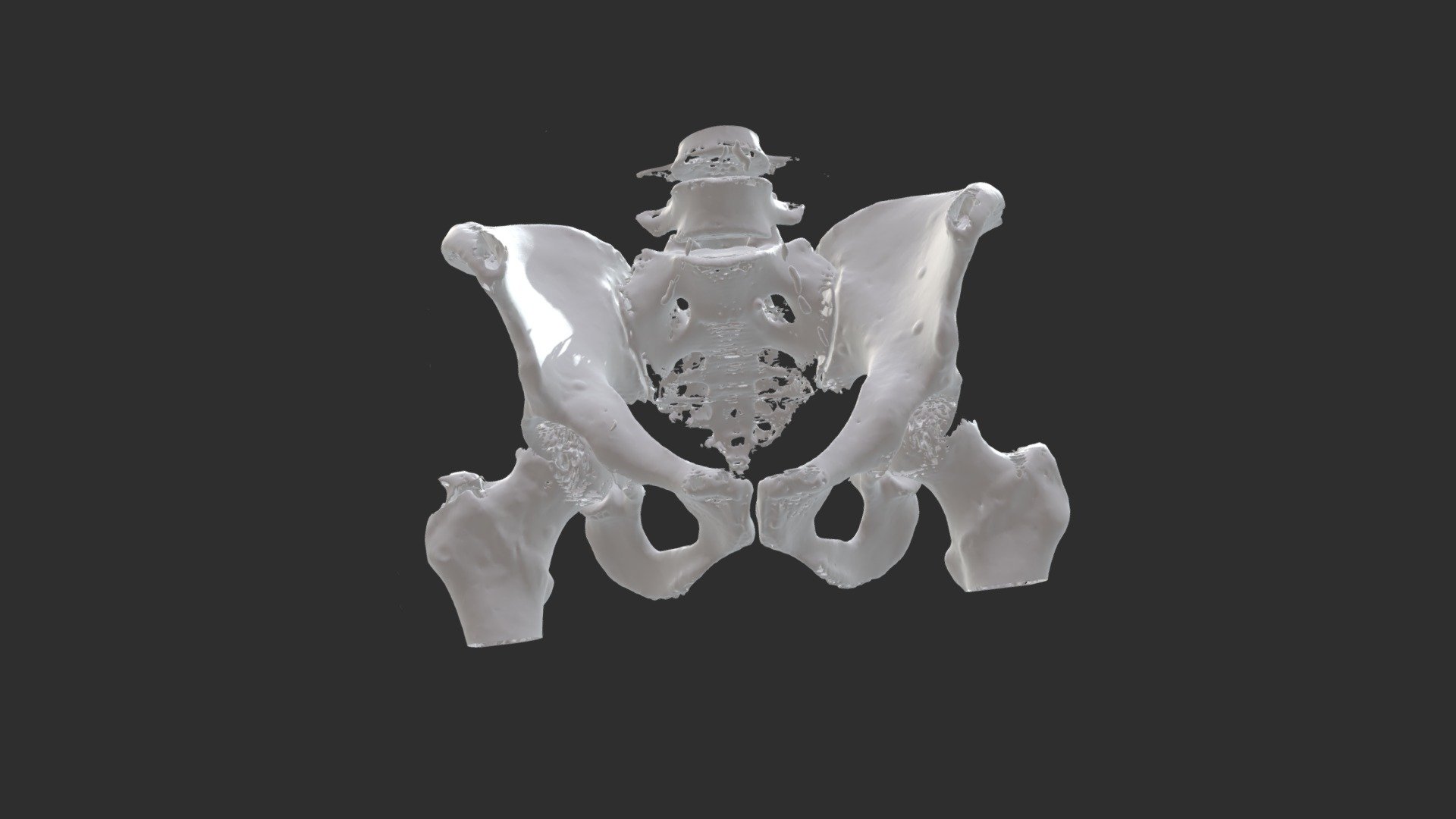 CT_final — Sketchfab embed 3D viewer