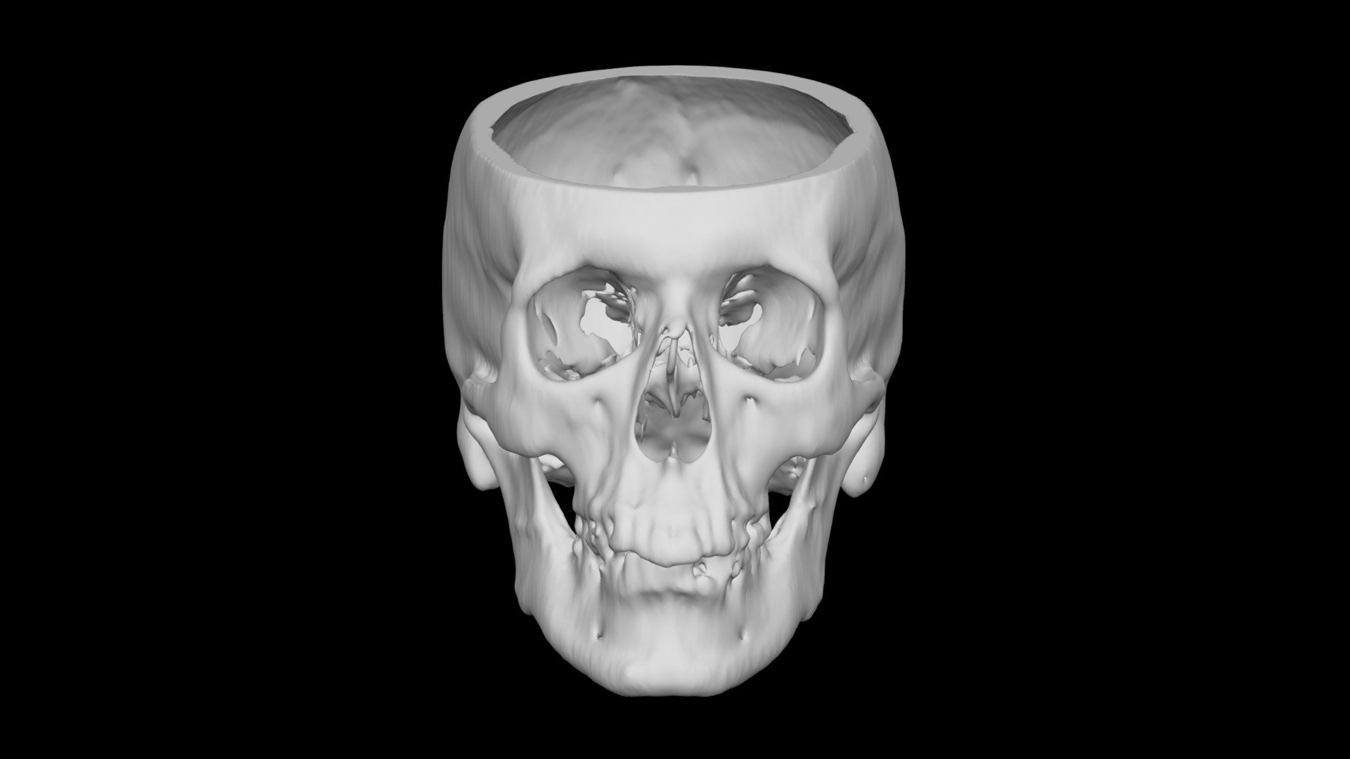 Skull Male 50yo