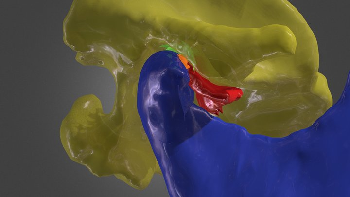 CBCT - MRI Joint registration 3D Model
