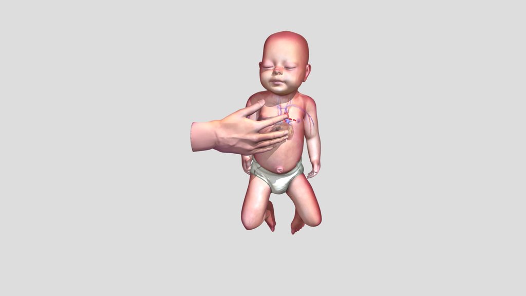 Infant resuscitation