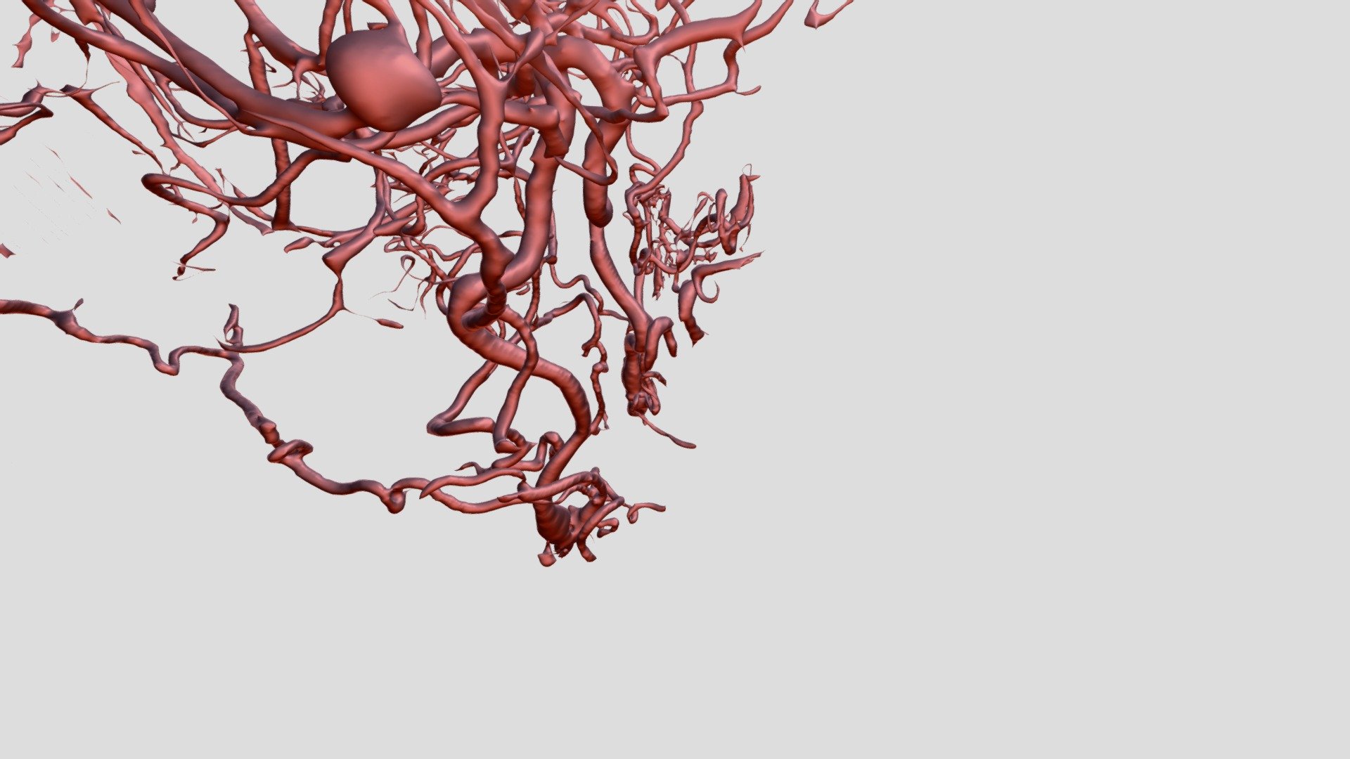 Segmentation_Artery_Th_0 10