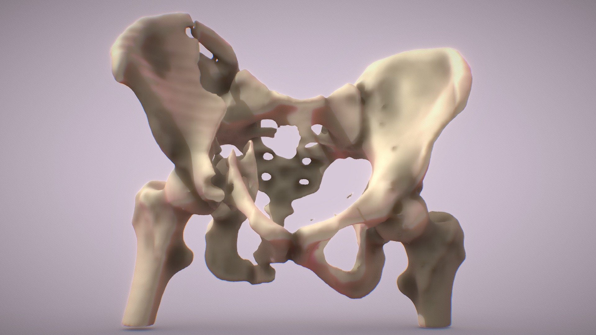 Segmentation of Pelvis - Hip Fracture - 3D model by gaemartho [48539b4 ...