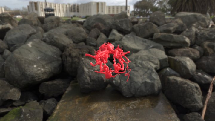 Aneurysm 3D Model
