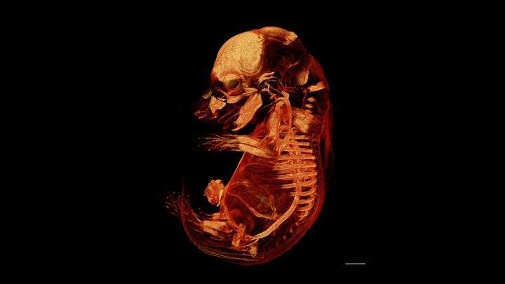 Whole-mount fast-green staining of mouse embryo 3D Model