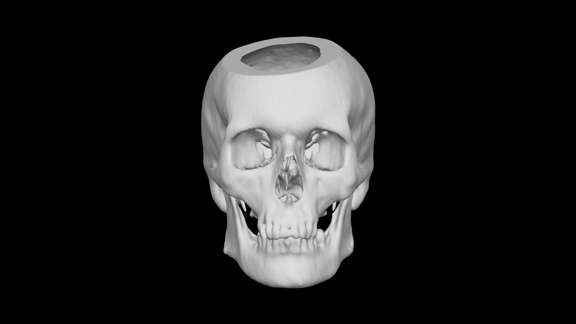 Skull Male 82yo