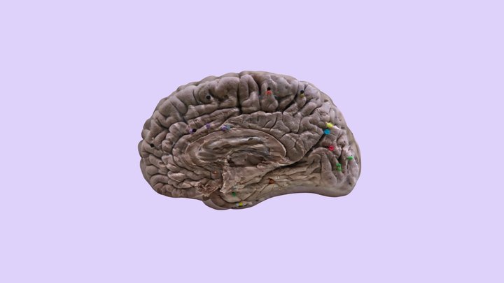 FinalBrain_8-5-24 3D Model