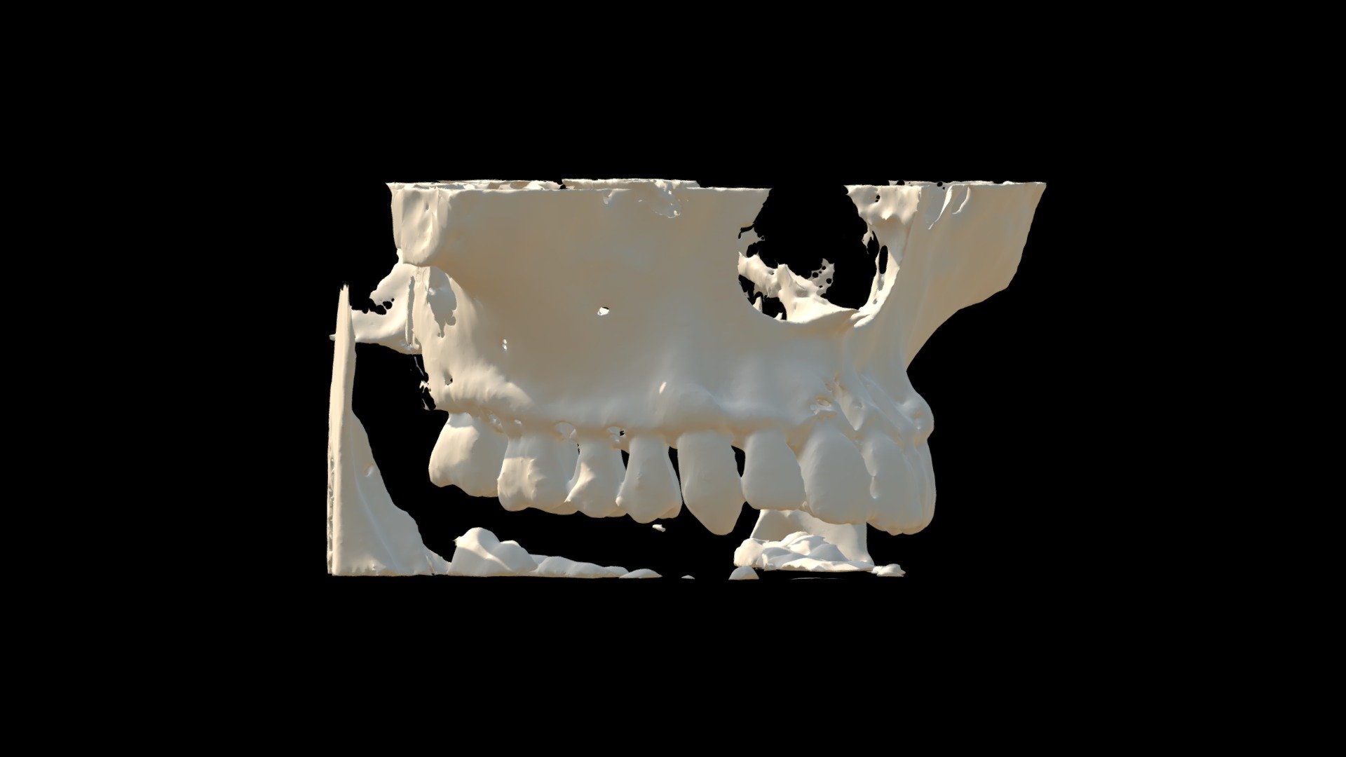 CBCT