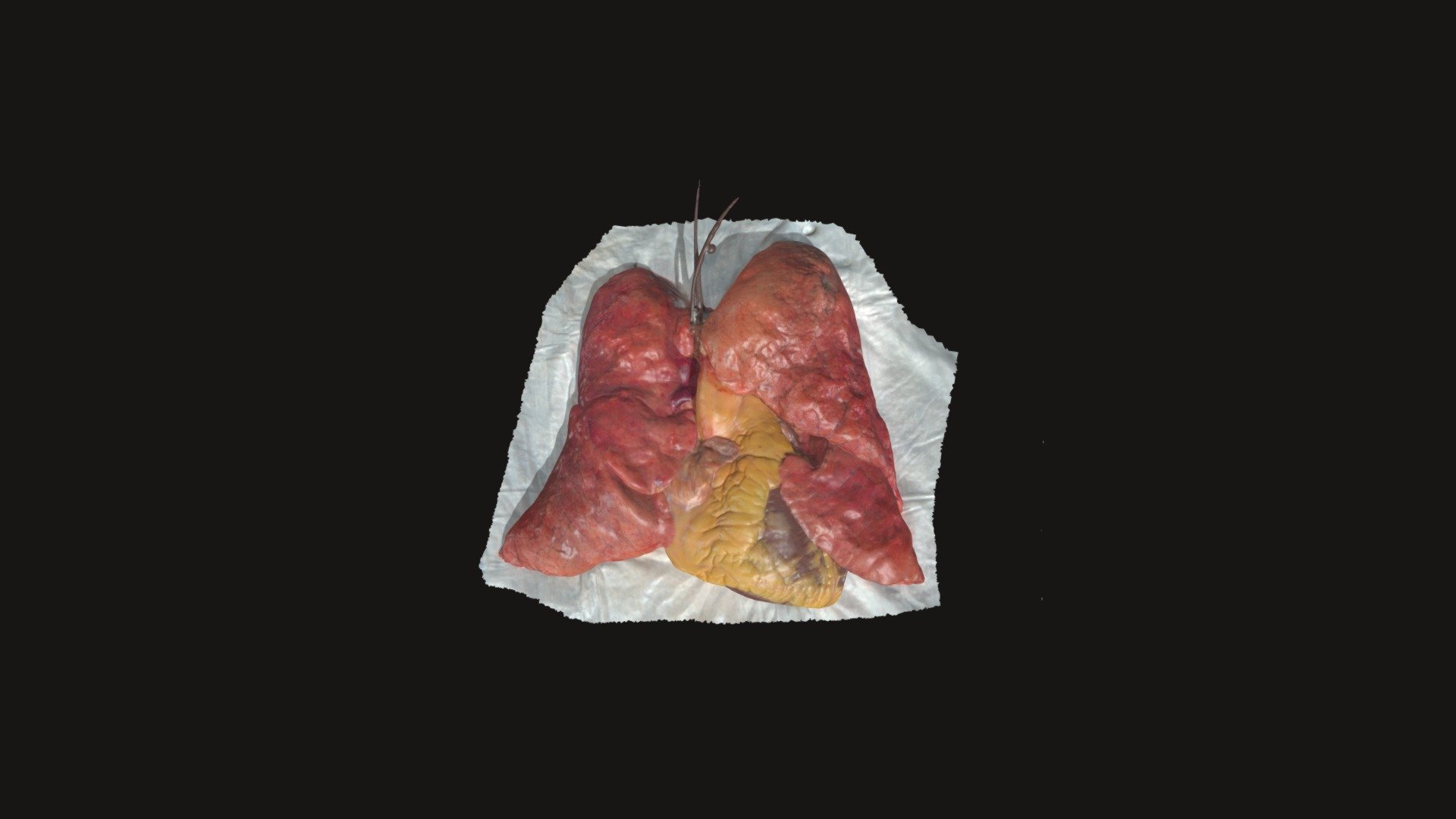 Fresh Human Heart & Lung Bloc