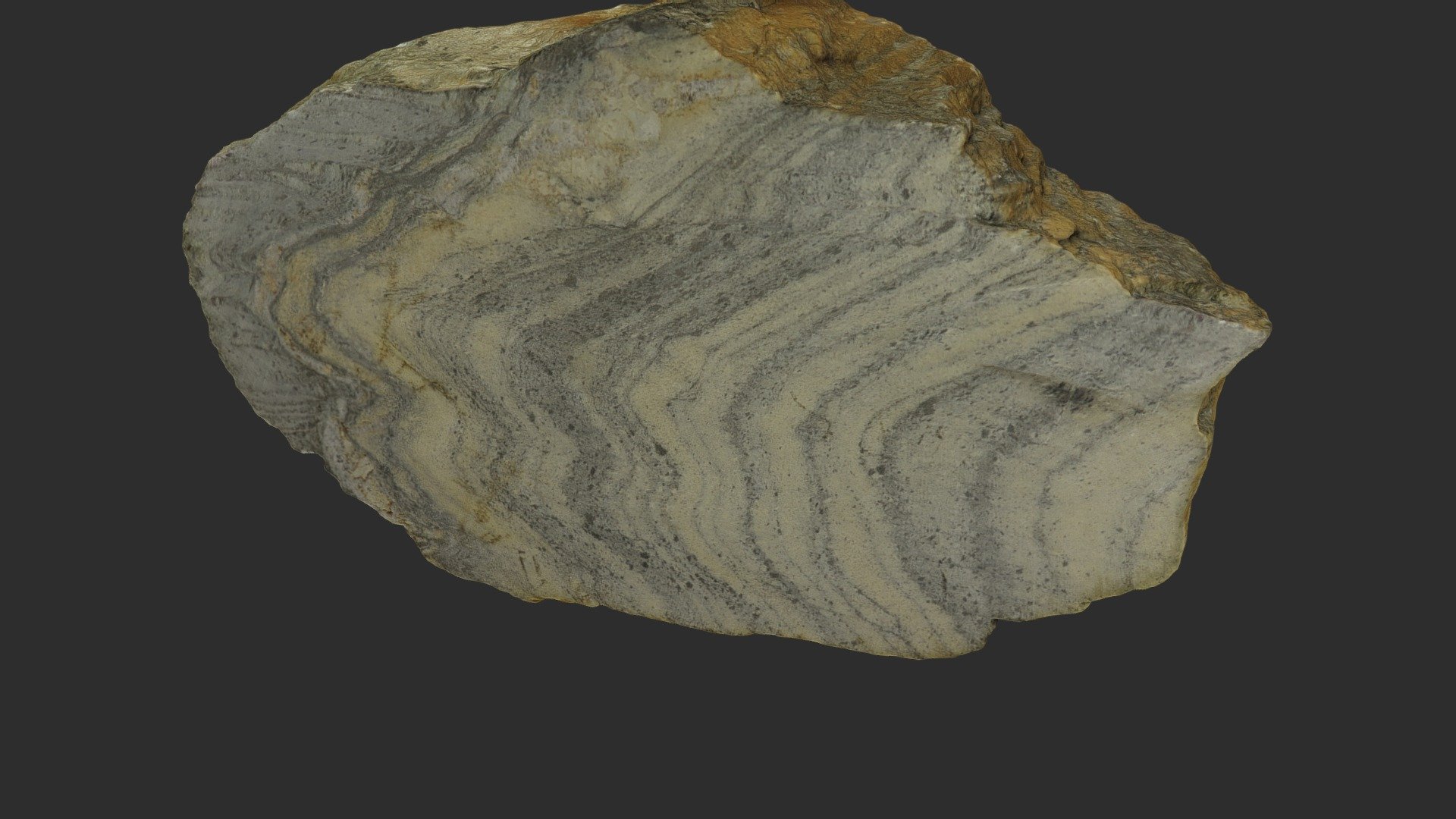 Axial-plane cleavage
