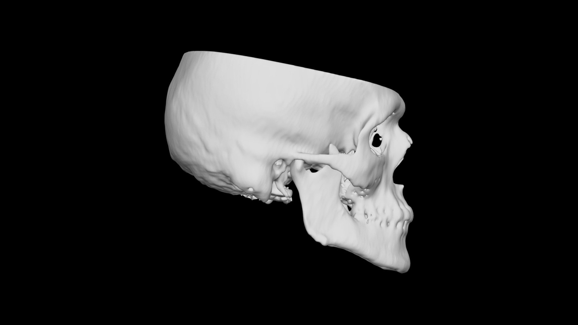 Skull Male 50yo