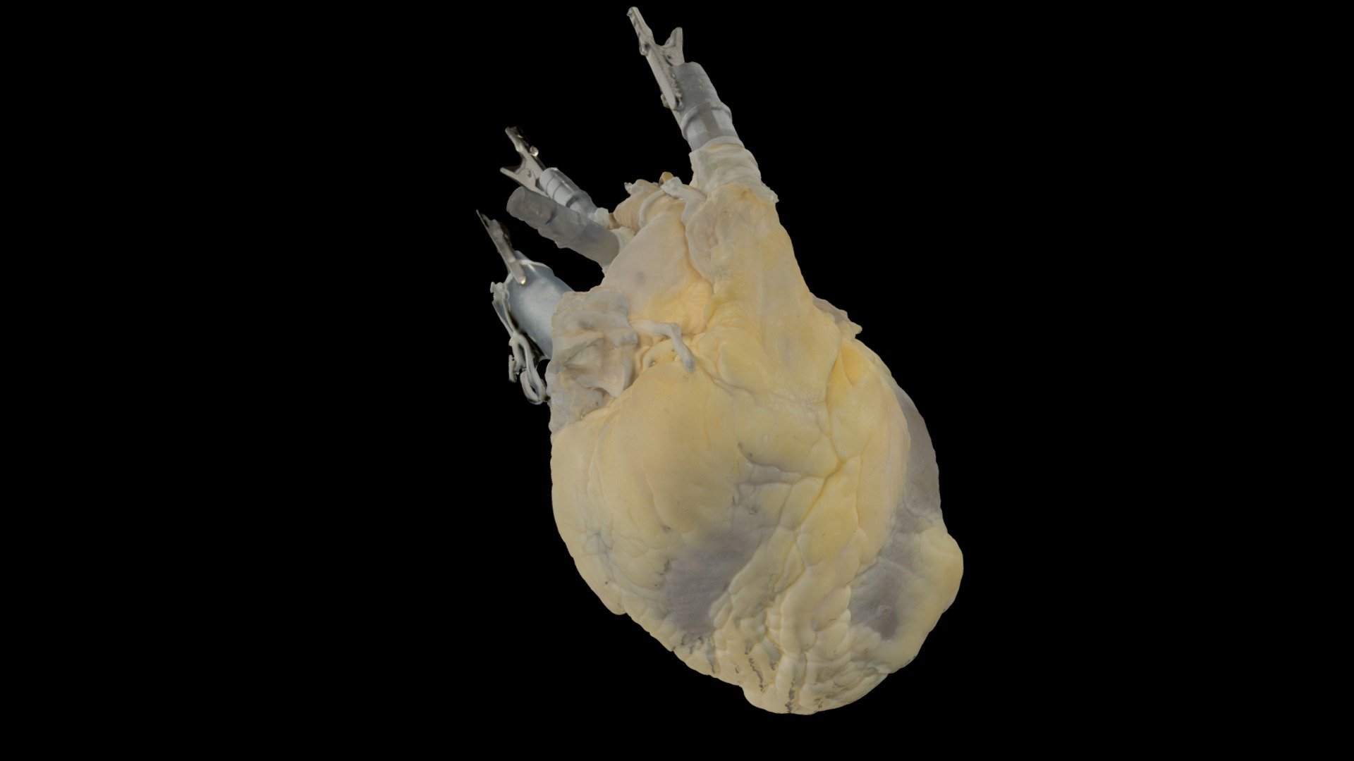 Human Heart 598 Perfusion Fixed