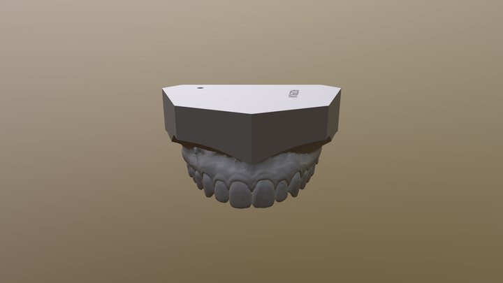 Dental STL Test 3D Model