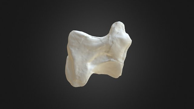 1310002 Ulnar Carpal Right 3D Model