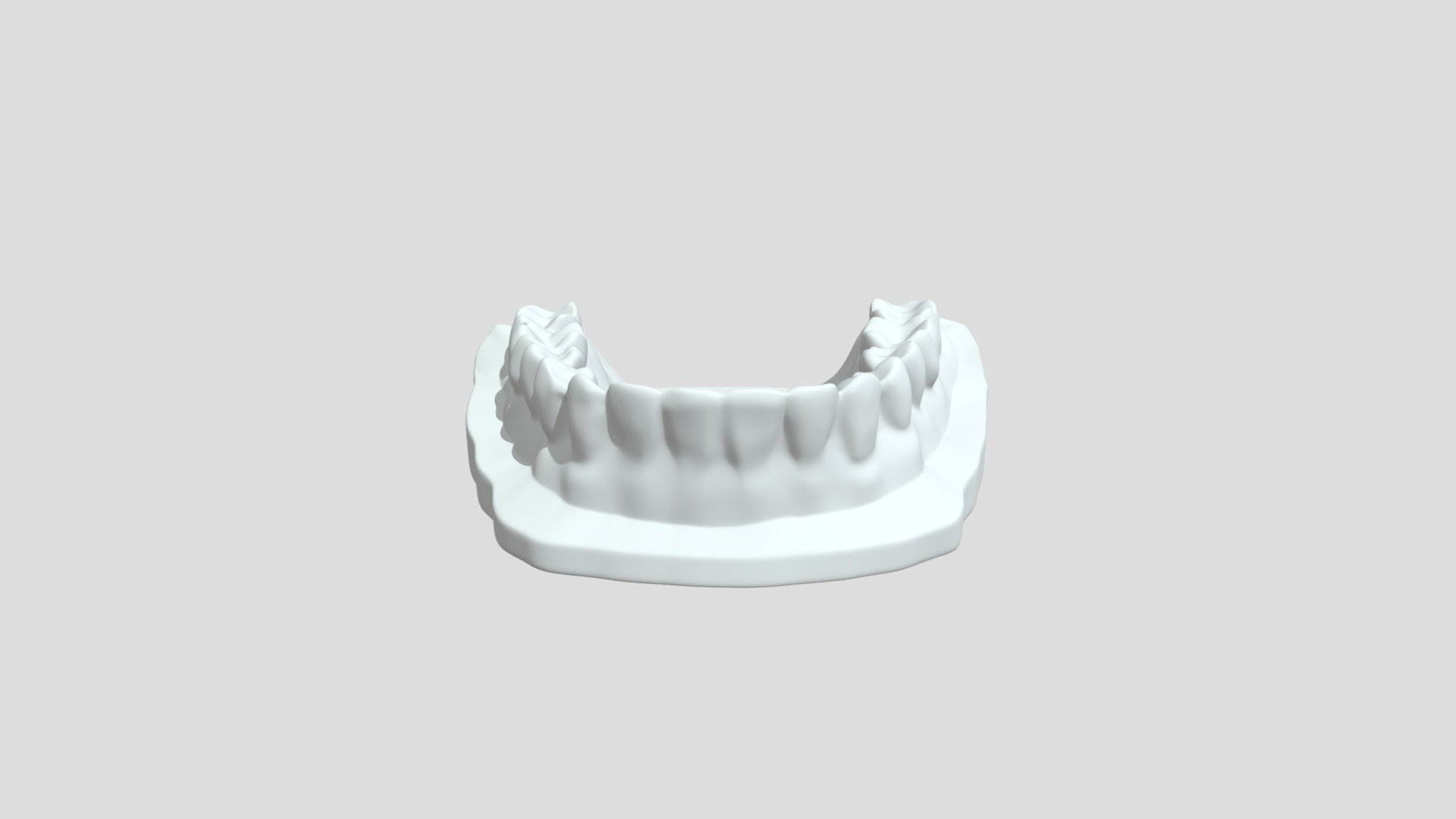 Lingual Retainer With Custom Pads And Template T - 3D model by ODL ...