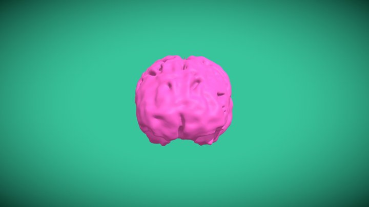 Segmentation_Brain 3D Model