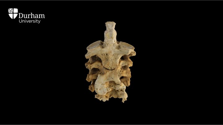 Cervical Vertebrae 3D Model