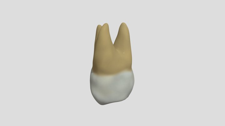 Maxillary Third Molar (Right)