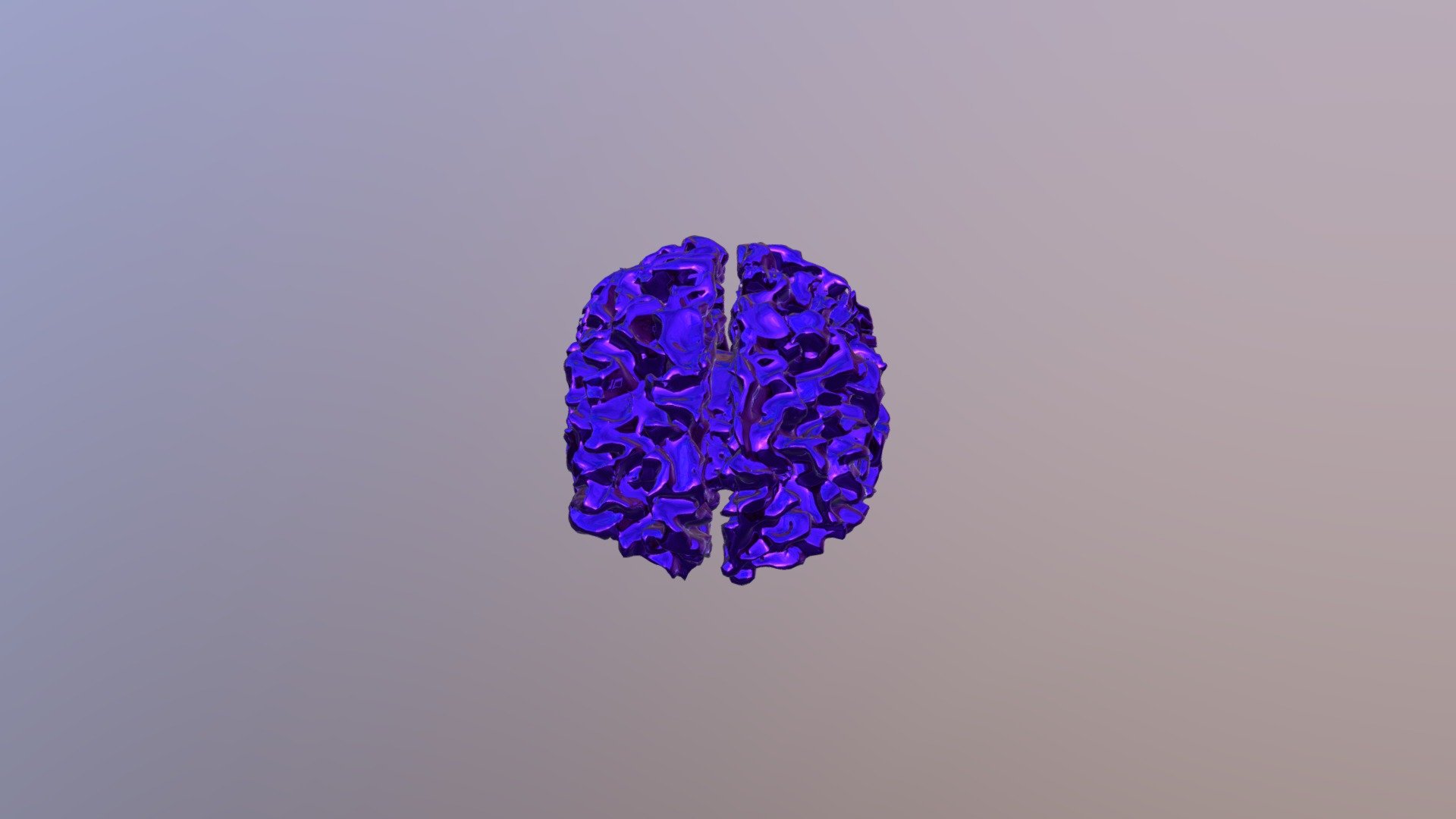 White Matter Fiber Tracts