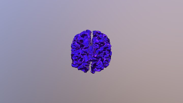 White Matter Fiber Tracts 3D Model