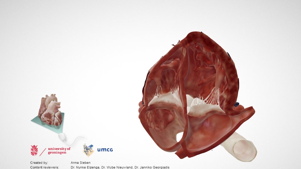 Cardiac Anatomy Apical 4 Chamber Echo Plane Download Free 3d Model By E Learning Umcg