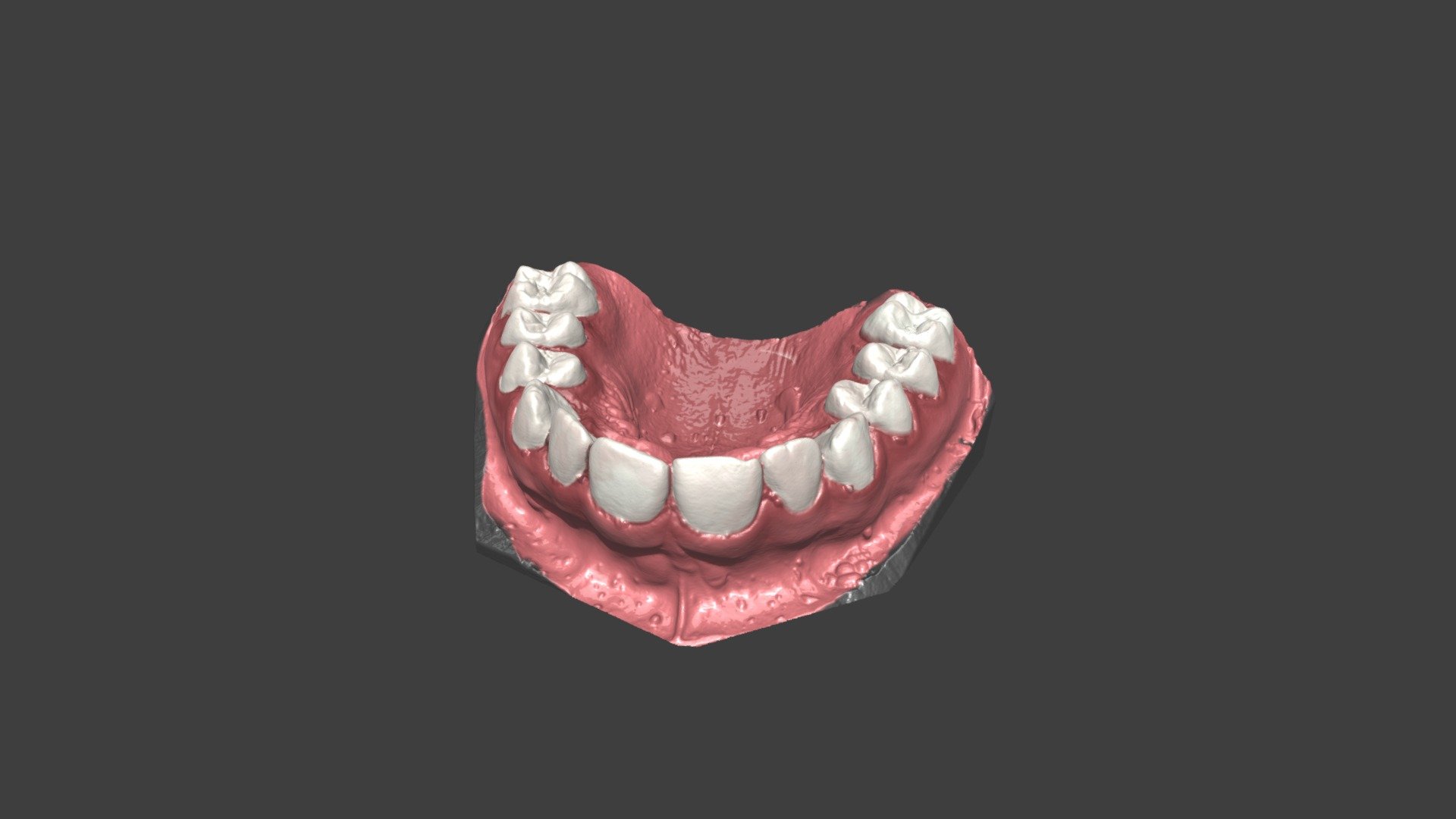 Test 2