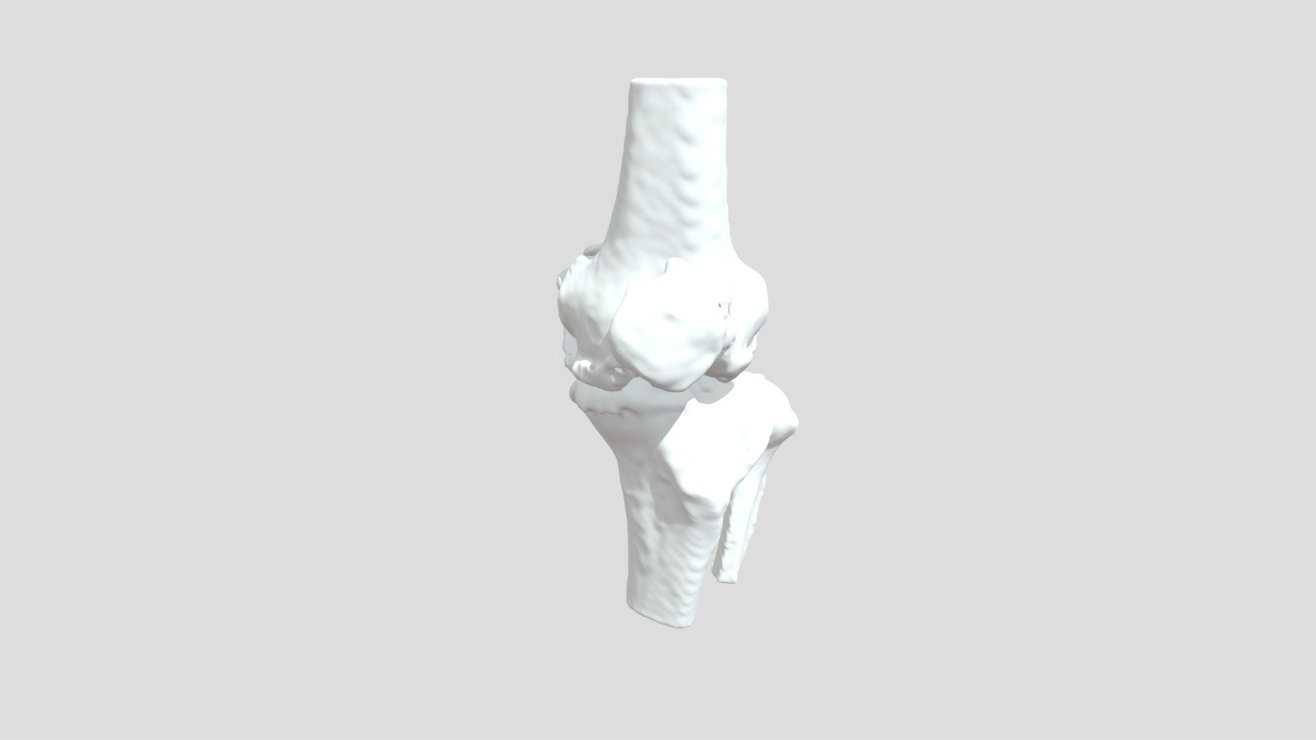 Segmentation Dpltbone
