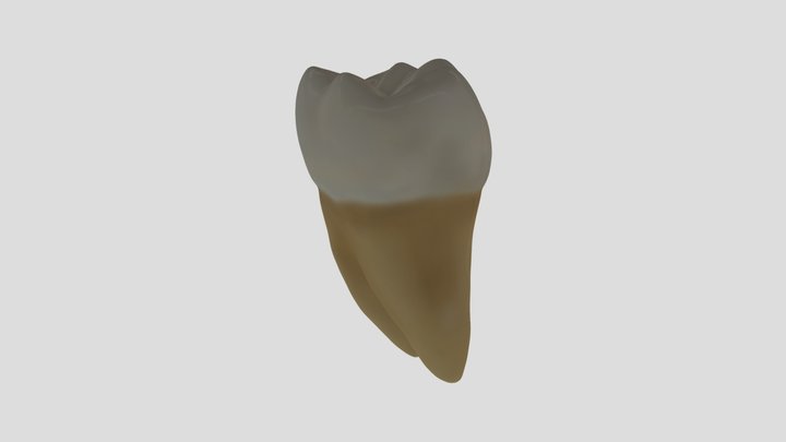 Mandibular First Molar (Right)