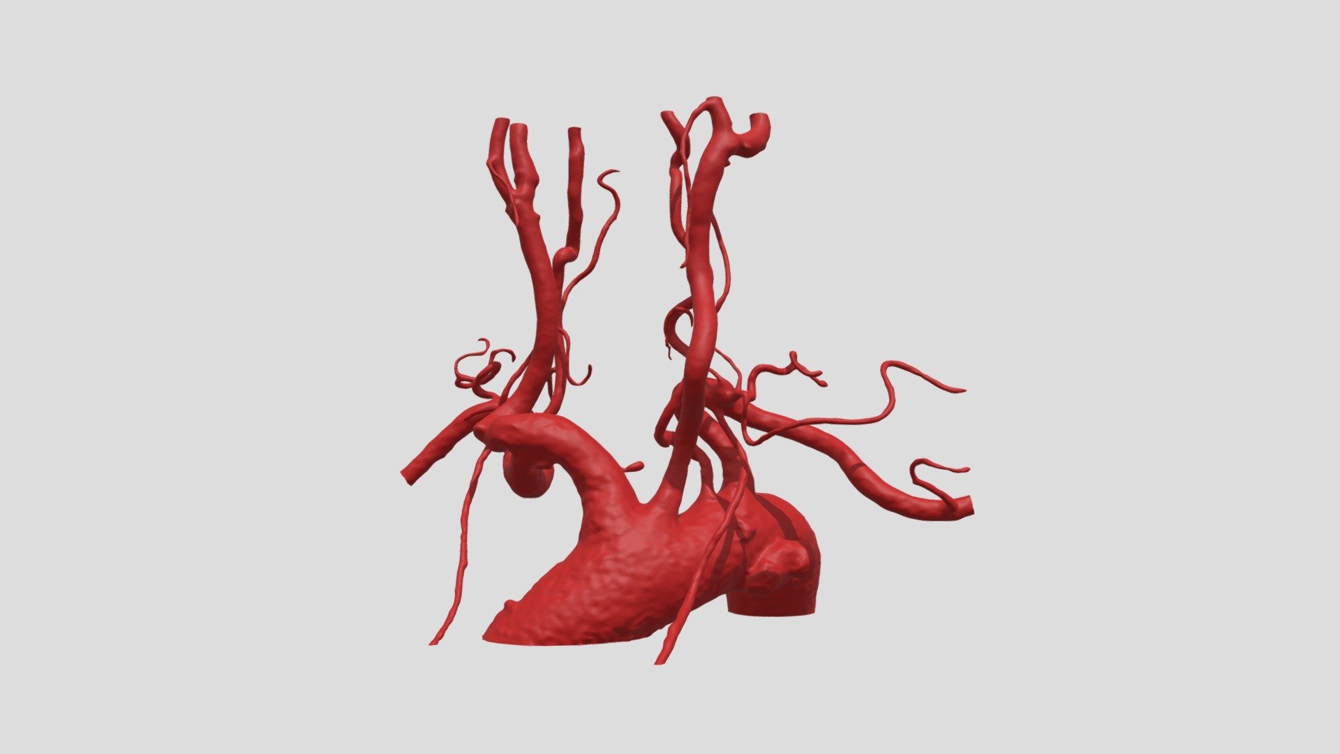 A32CIA29122021_AORTA_pulita