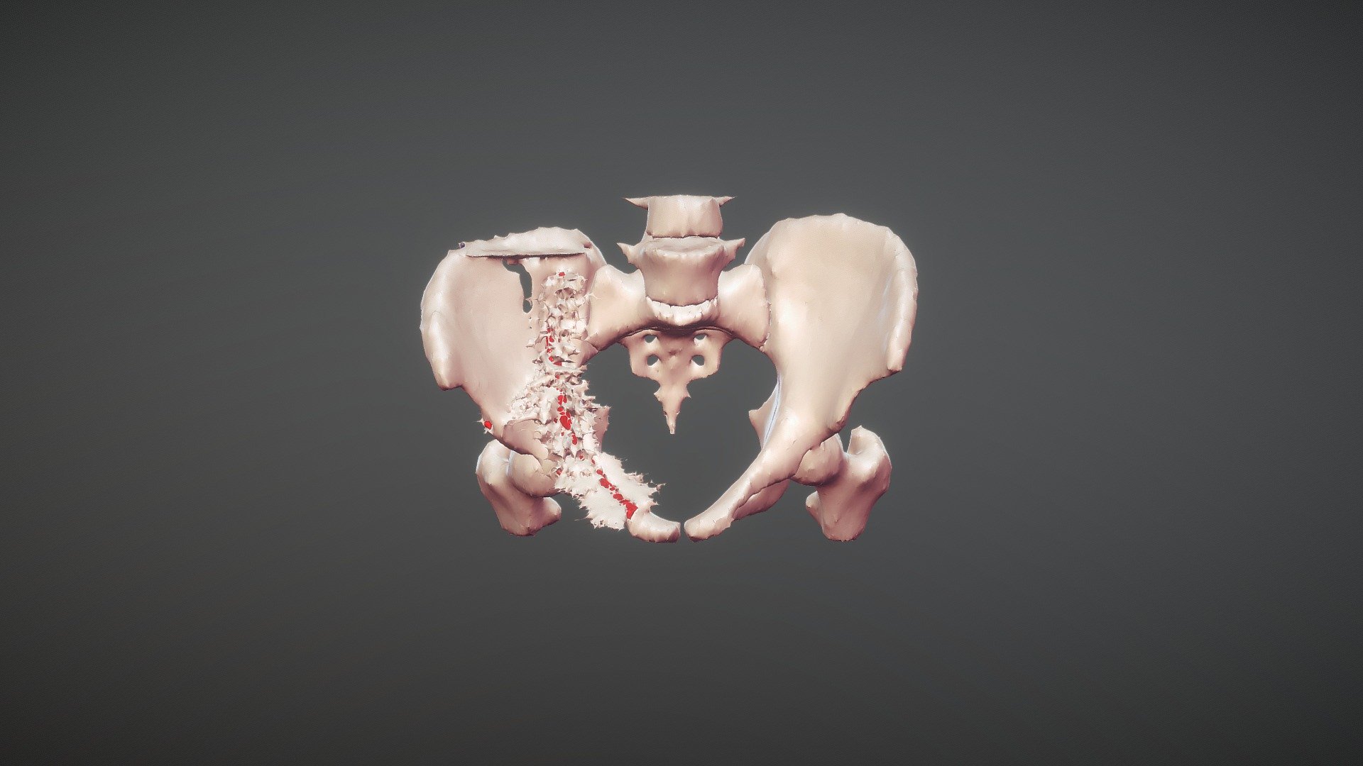 Pelvic Segmentation