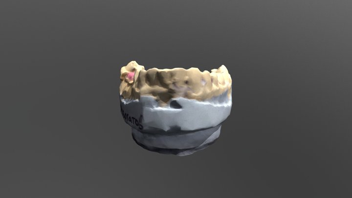 Teeth_Old 3D Model