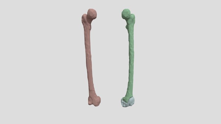 Femur and Implants 2025 3D Model