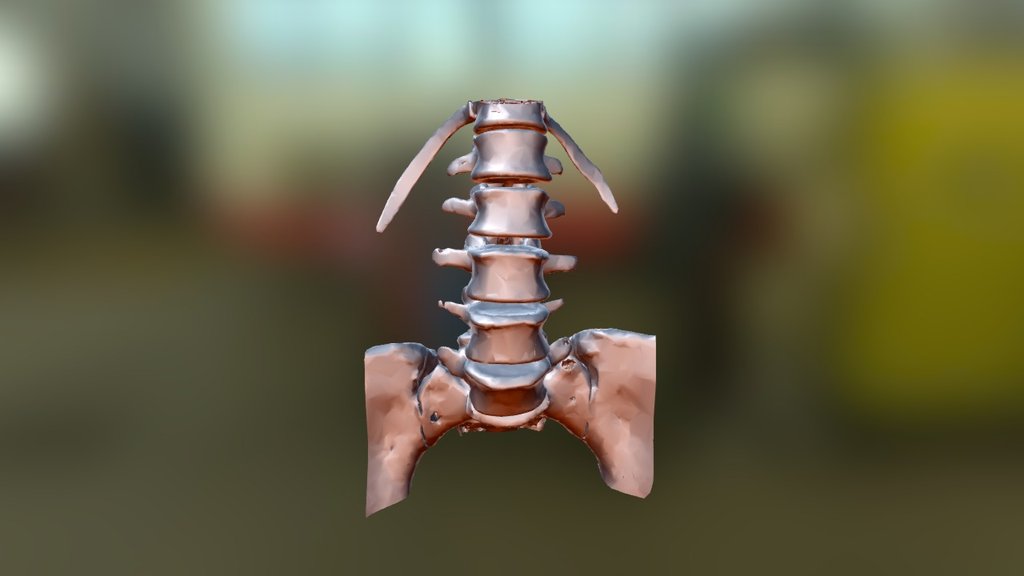 Lumbar Spine - sku 095 - 3D model by orto3d [4c288e8] - Sketchfab