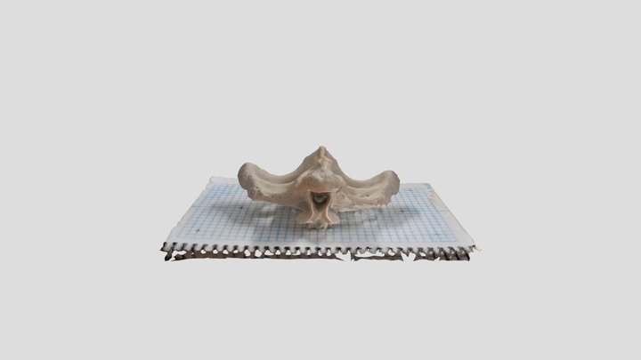250717 pelvis 03 (scan 2 of 2)
