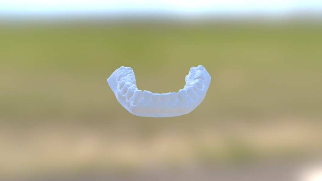 Rob Lower Jaw