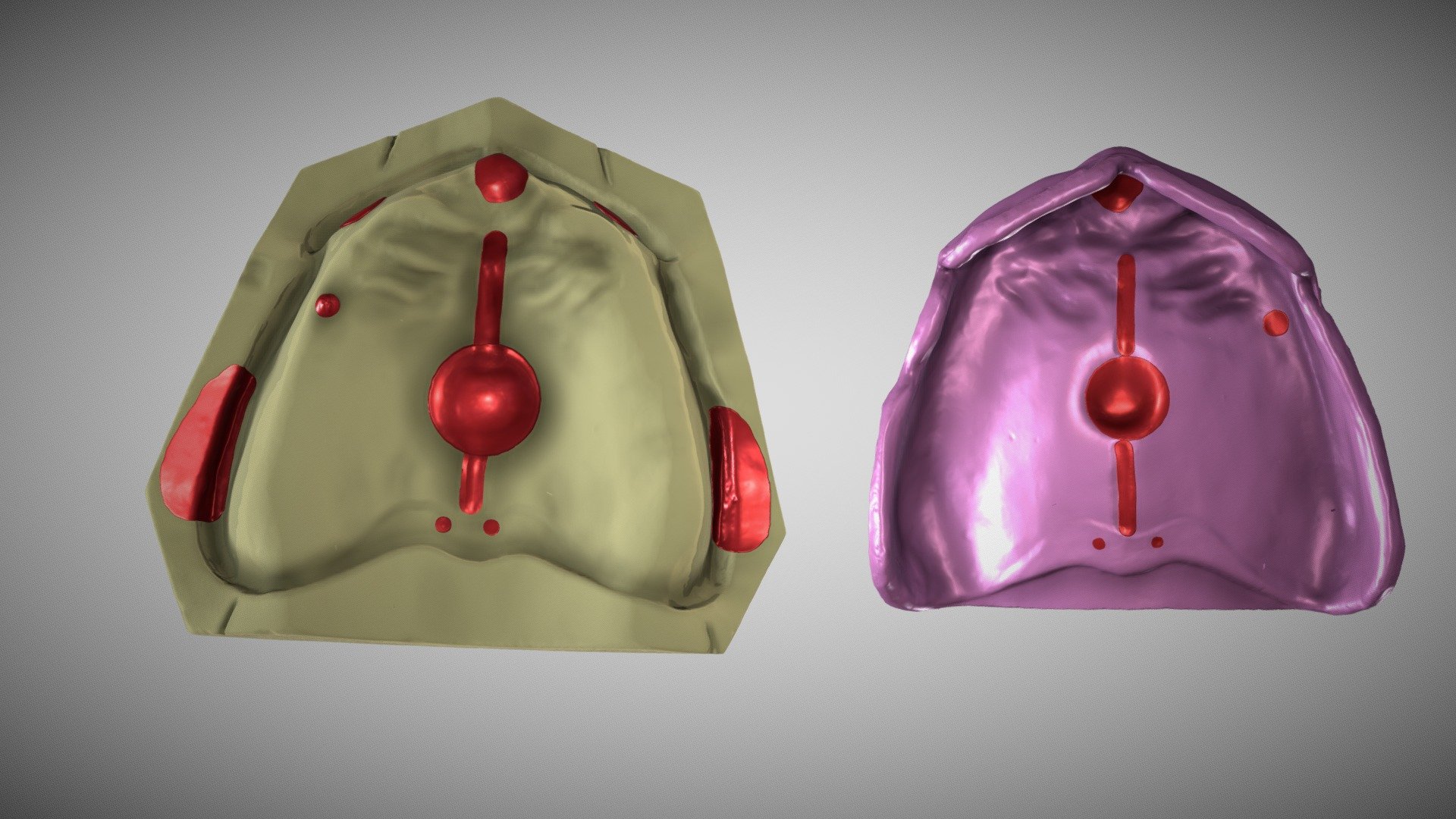 Maxillary Relief Areas - 3D model by Muhammad Nabeel ...
