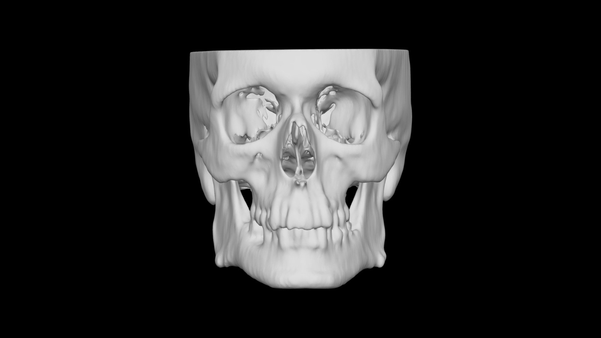 Skull Male 39yo