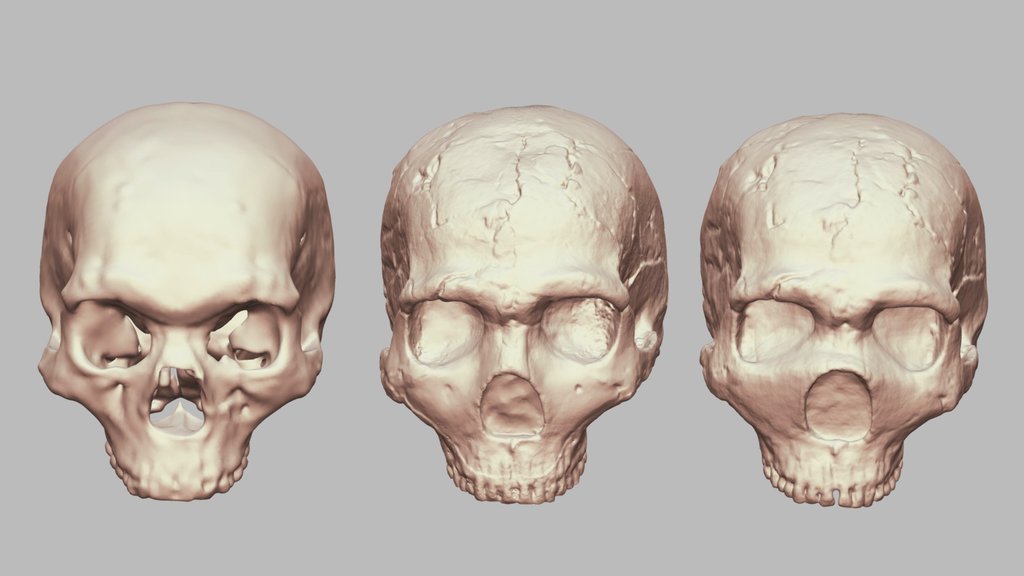 Amud1 Crania Reconstruction