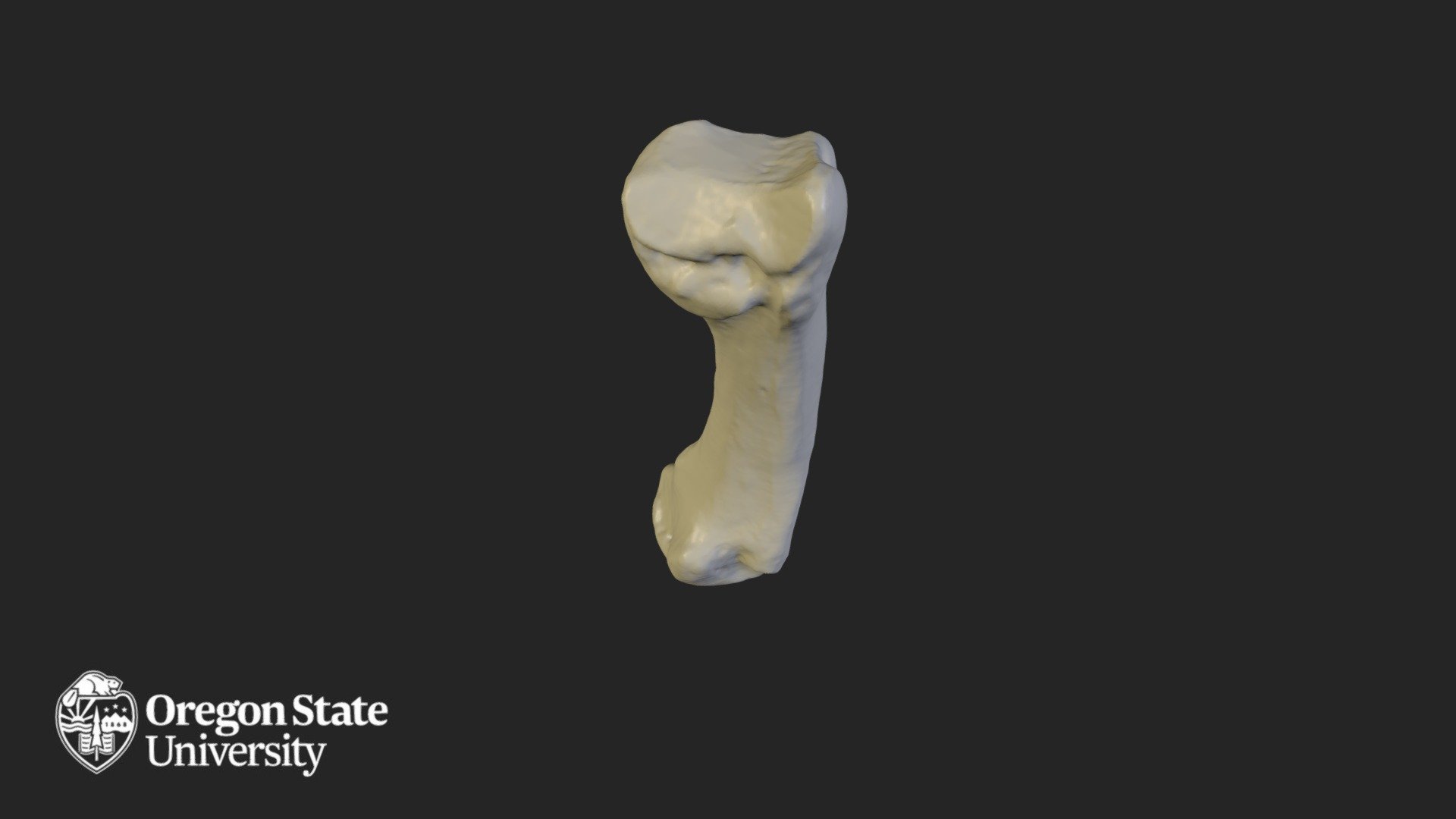 Metacarpal 3
