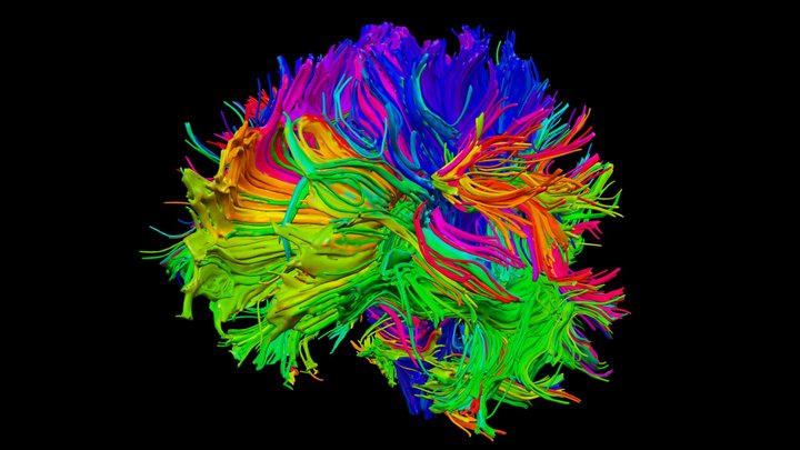 Tractography from MRI 2.0 3D Model