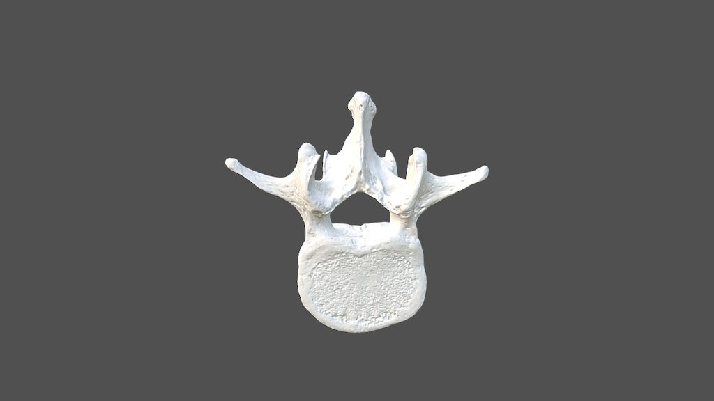 Lumbar Vertebra 2