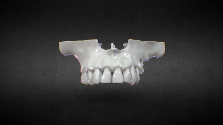 sinus 3D Model