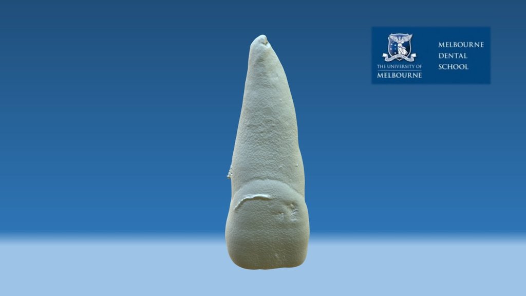 Permanent central upper incisor
