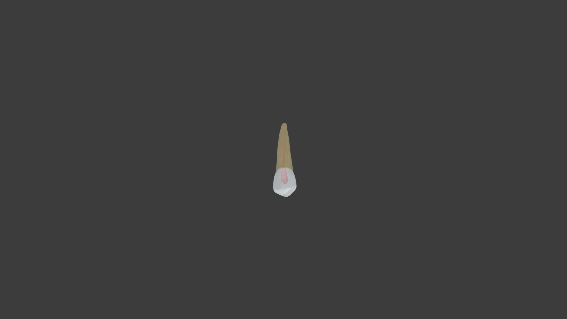 Maxillary 2nd Premolar Type 1