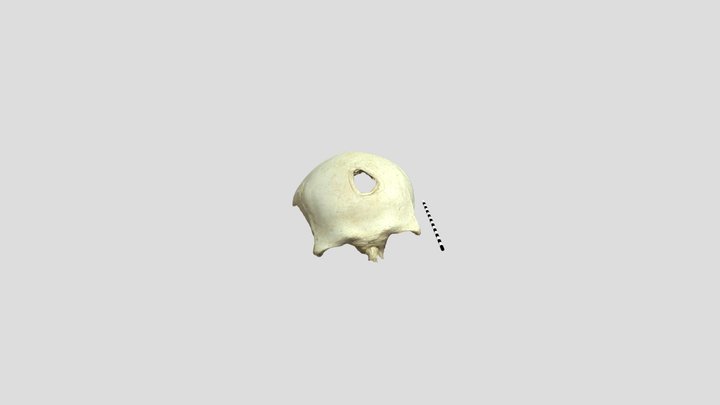 Crâne trépané néolithique, Us 3D Model