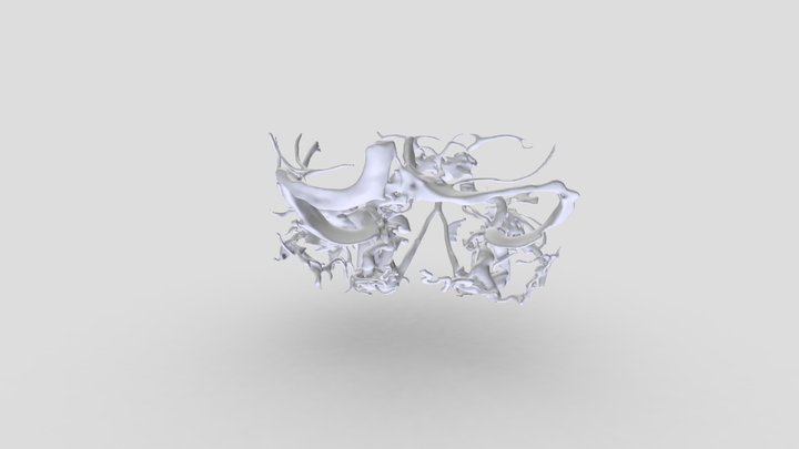 MRI scan 3D Model