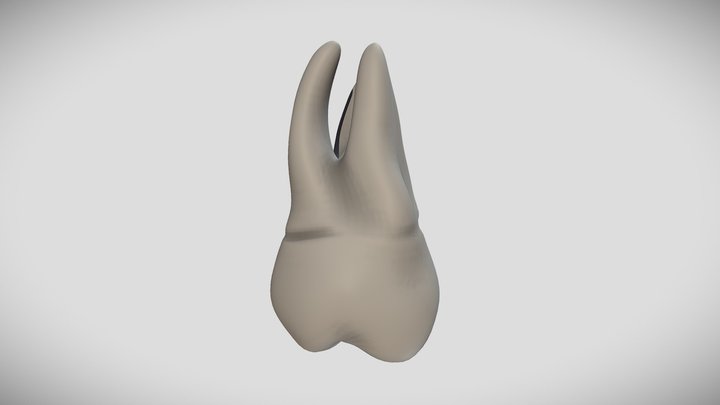 Maxillary second molar 3D Model