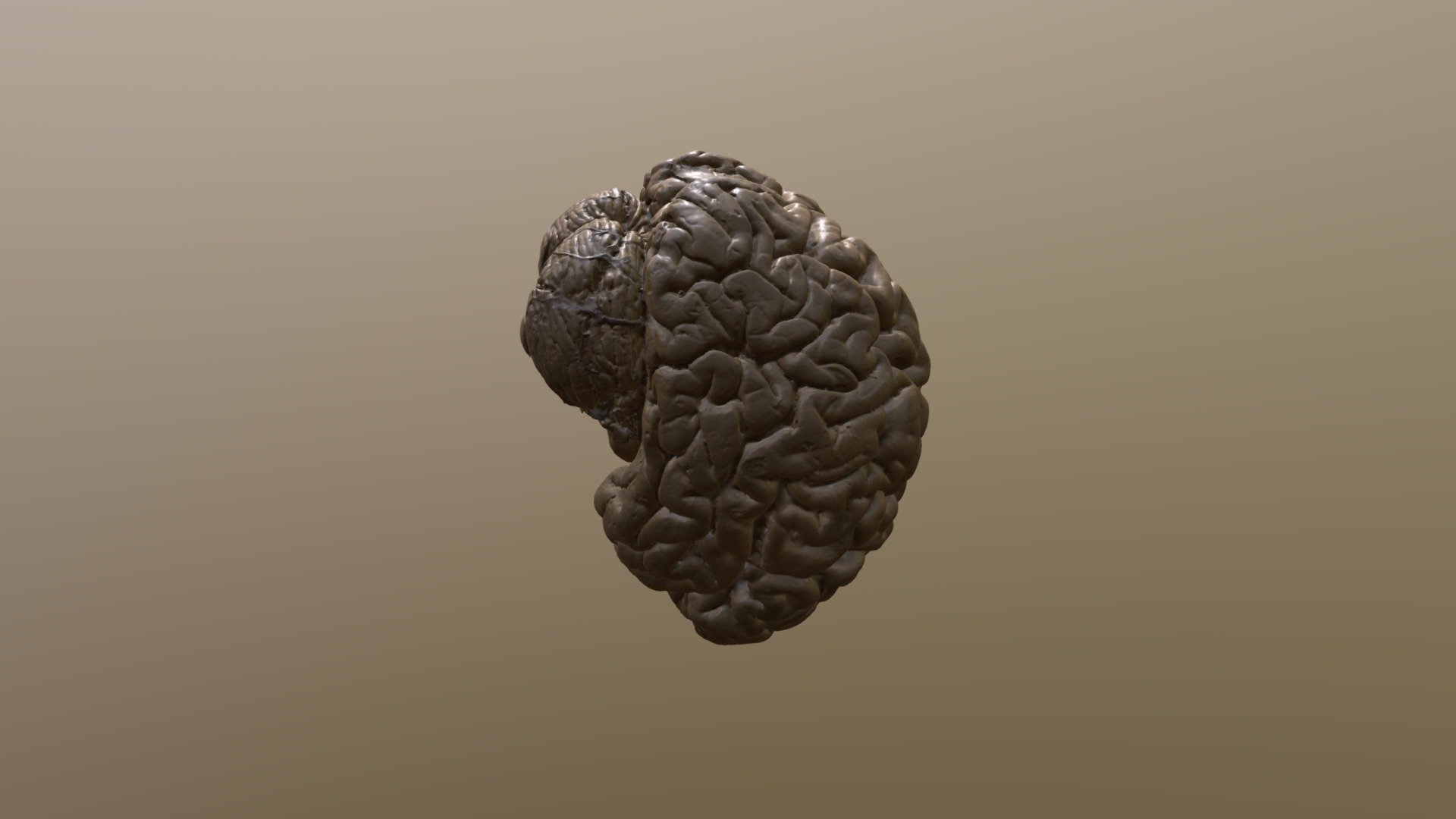 Brain without dura mater